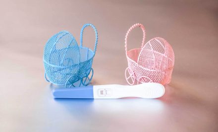Sexagem fetal: Conheça o exame que revela o sexo do bebê na 8ª semana de gestação