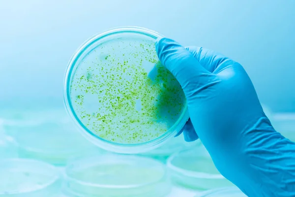 Exames de Microbioma: O Que Eles Revelam Sobre Seu Corpo