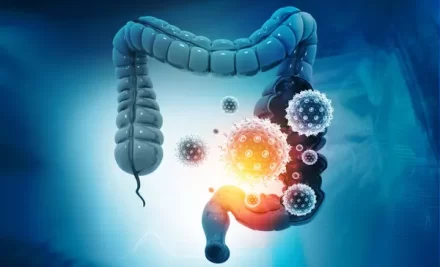A Conexão entre Microbioma, Dieta e Doenças Inflamatórias Intestinais