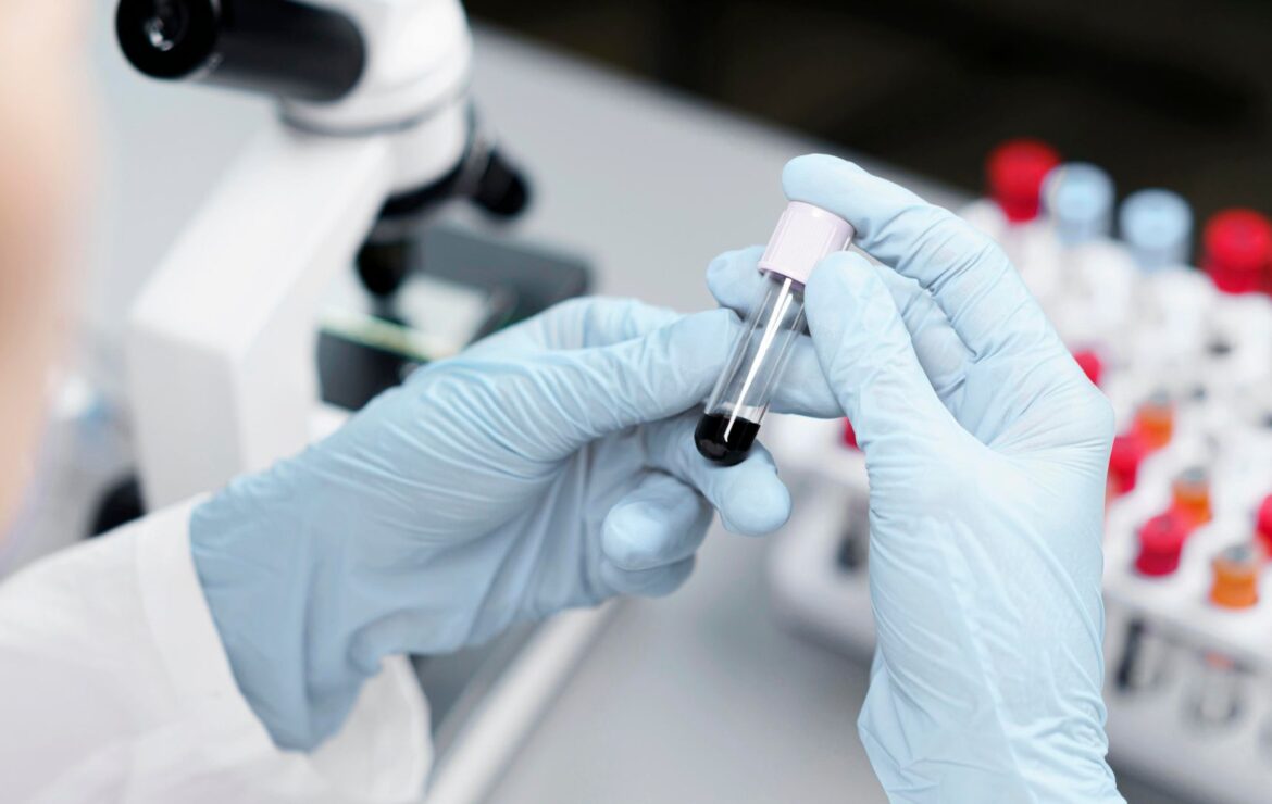 Como os exames laboratoriais auxiliam no monitoramento do Diabetes?