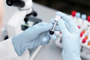 Como os exames laboratoriais auxiliam no monitoramento do Diabetes?