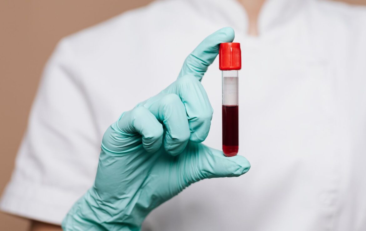 Hemograma: o que este exame avalia?