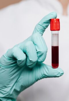 Hemograma: o que este exame avalia?