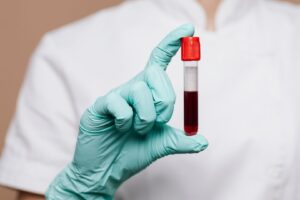 Hemograma: o que este exame avalia?