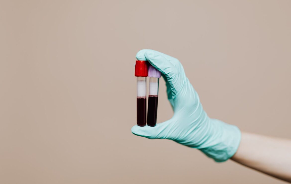 Coagulograma: quando este exame é indicado?