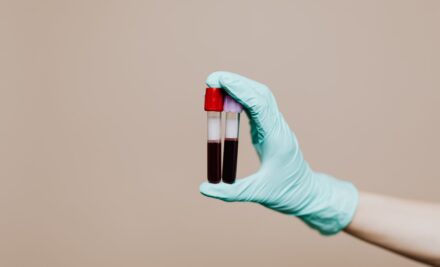 Coagulograma: quando este exame é indicado?