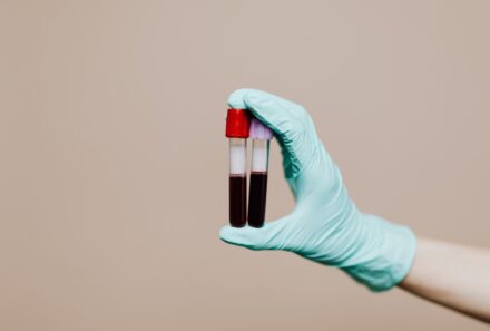 Coagulograma: quando este exame é indicado?