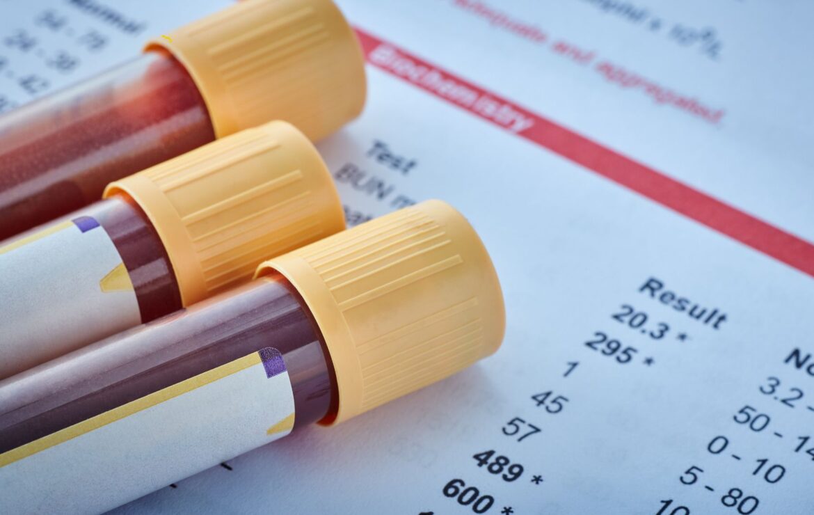 Como os exames laboratoriais podem contribuir para a saúde mental