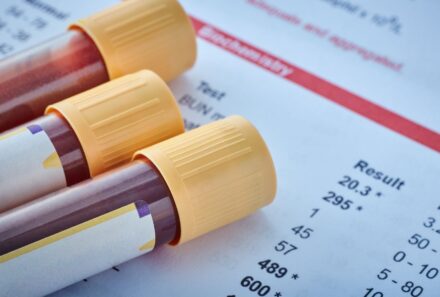 Como os exames laboratoriais podem contribuir para a saúde mental